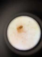 4 gemaakt met een Heine Delta 30 Pro