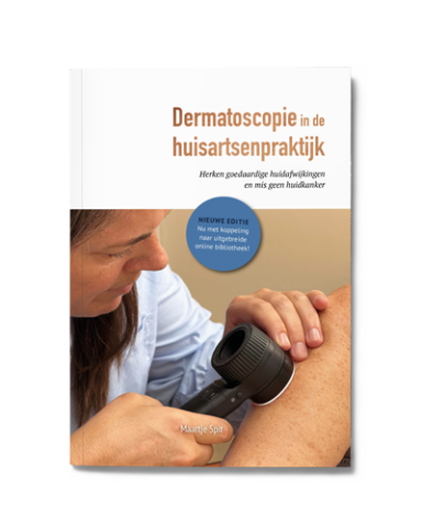Praktsich handboek dermotoscopie in de huisartenpraktijk