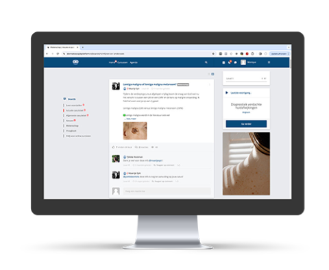 lidmaatschap dermatoscopieplatform.nl