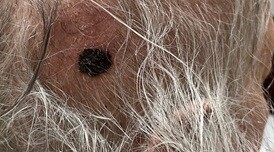 Macro huid van kleur bcc