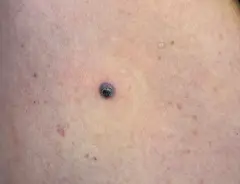 Macro origineel